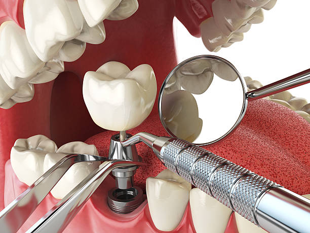 Best Walk-In Emergency Dental Services in Corry, PA